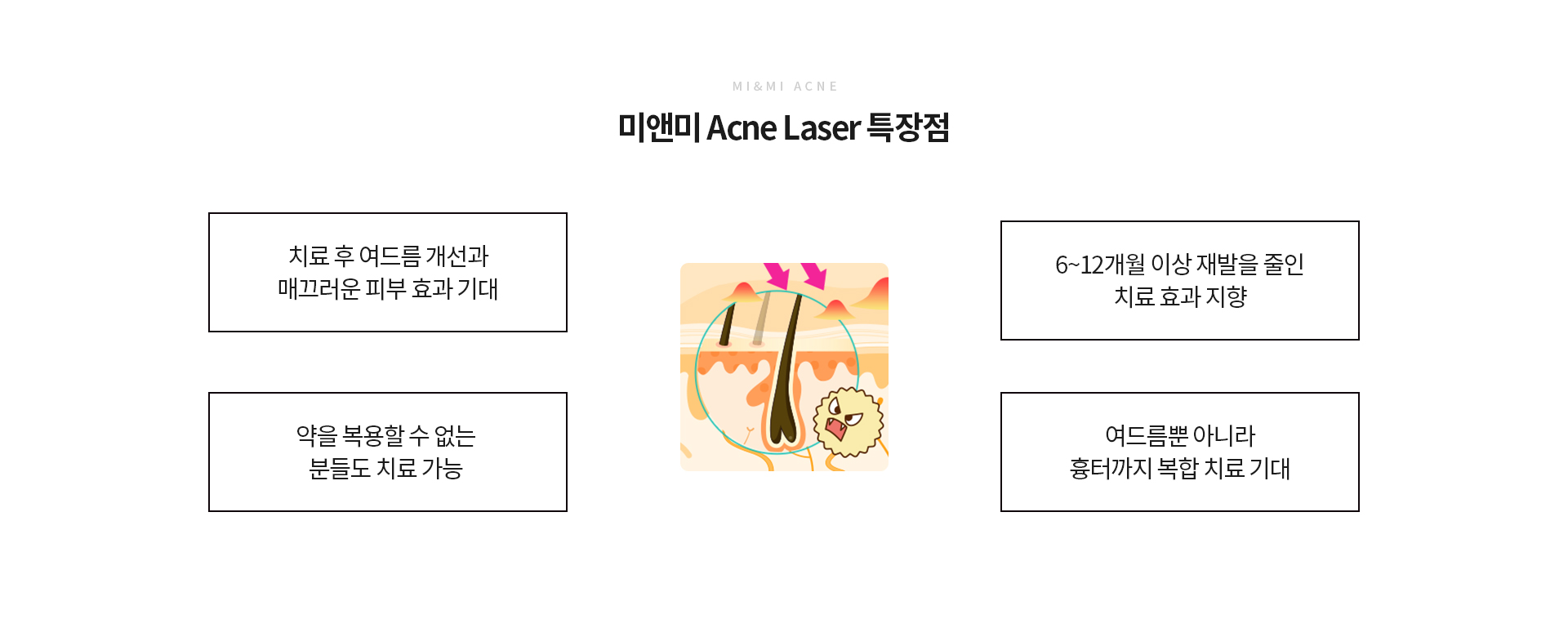 특장점