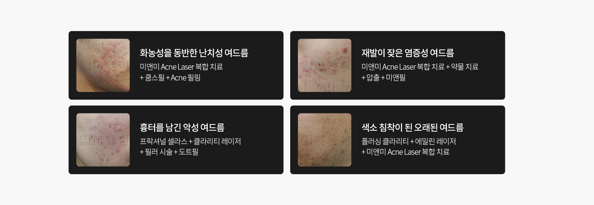 여드름시술전