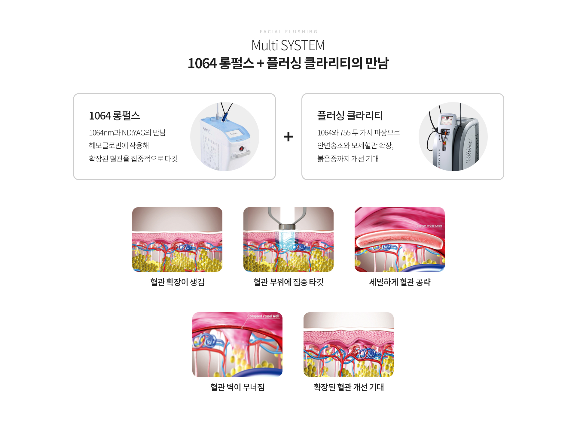 멀티시스템