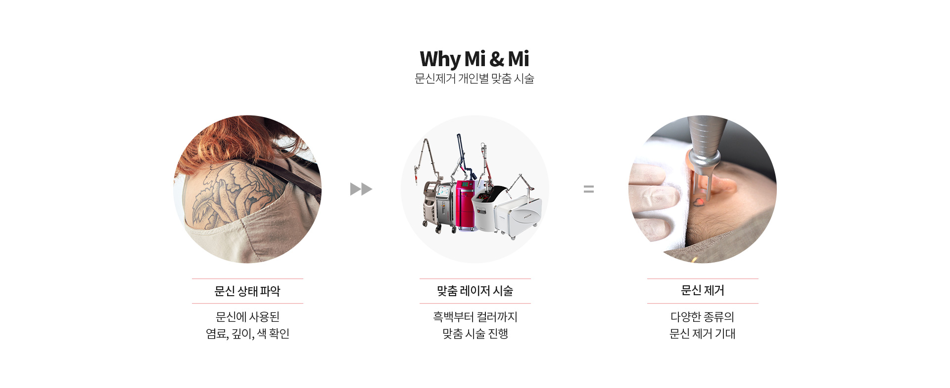 문신제거