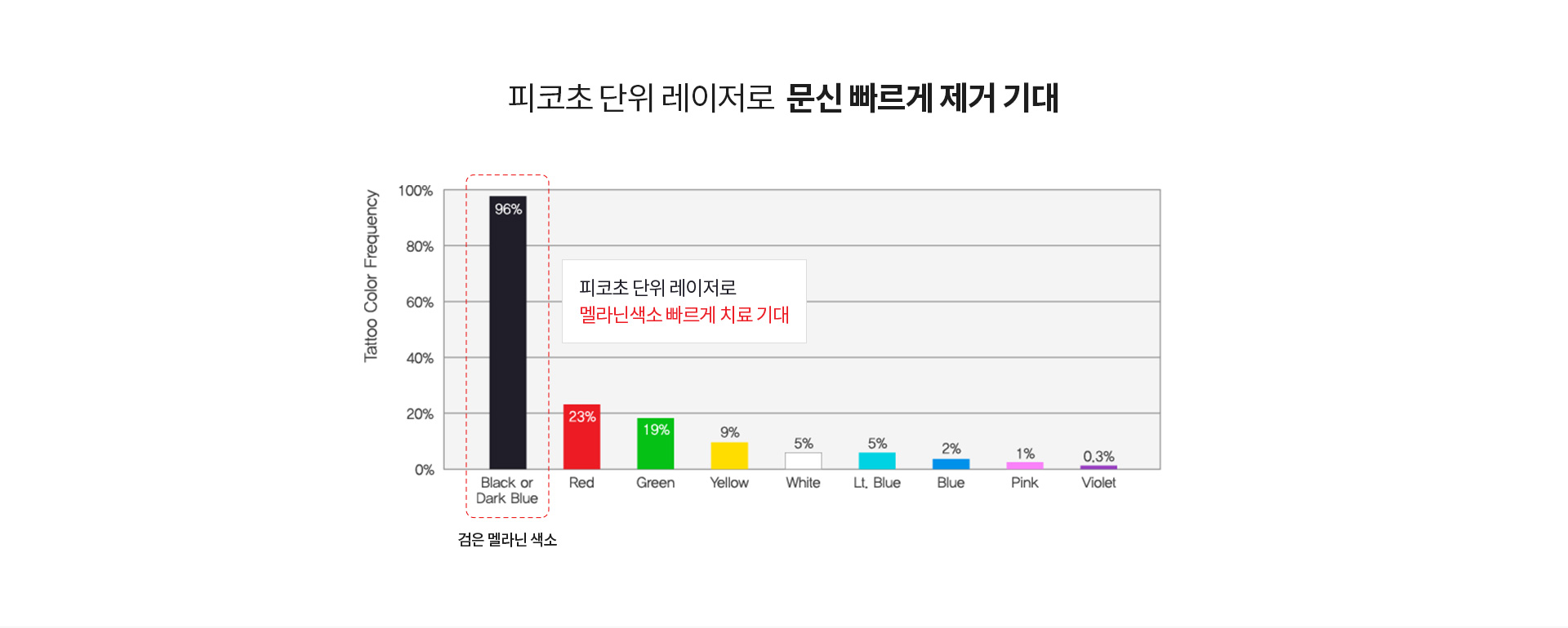 문신제거