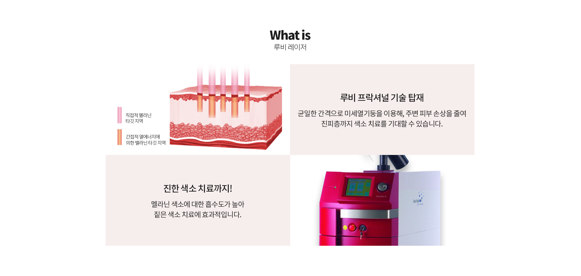문신제거