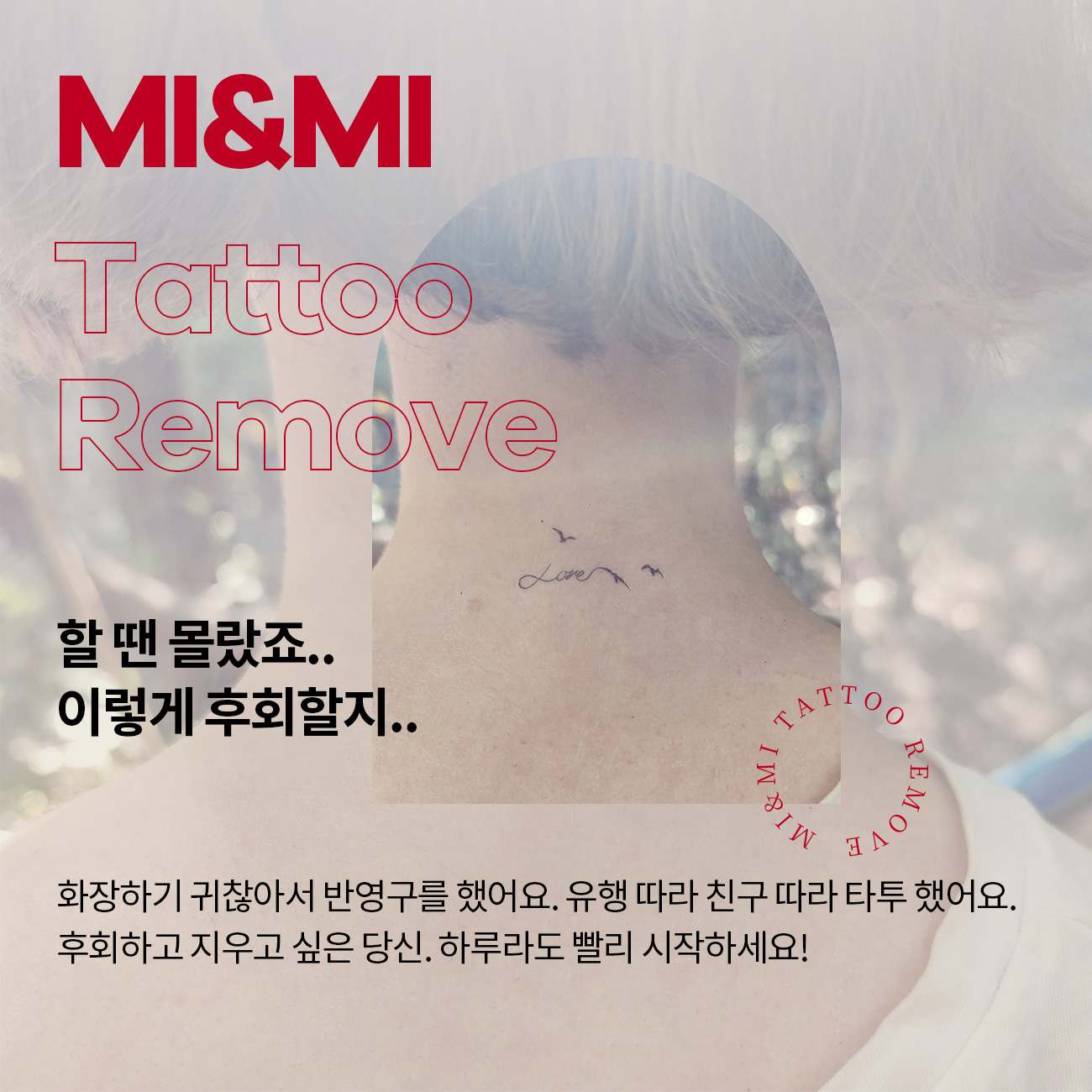 문신제거