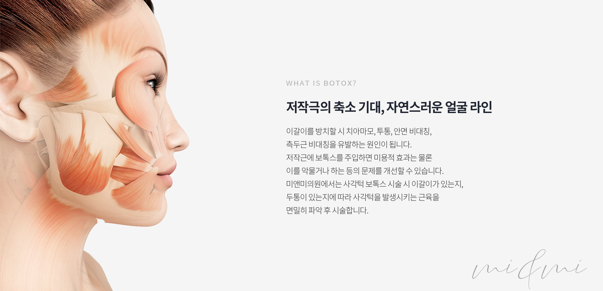 저작극의 축소 기대, 자연스러운 얼굴 라인 미앤미 사각턱보톡스