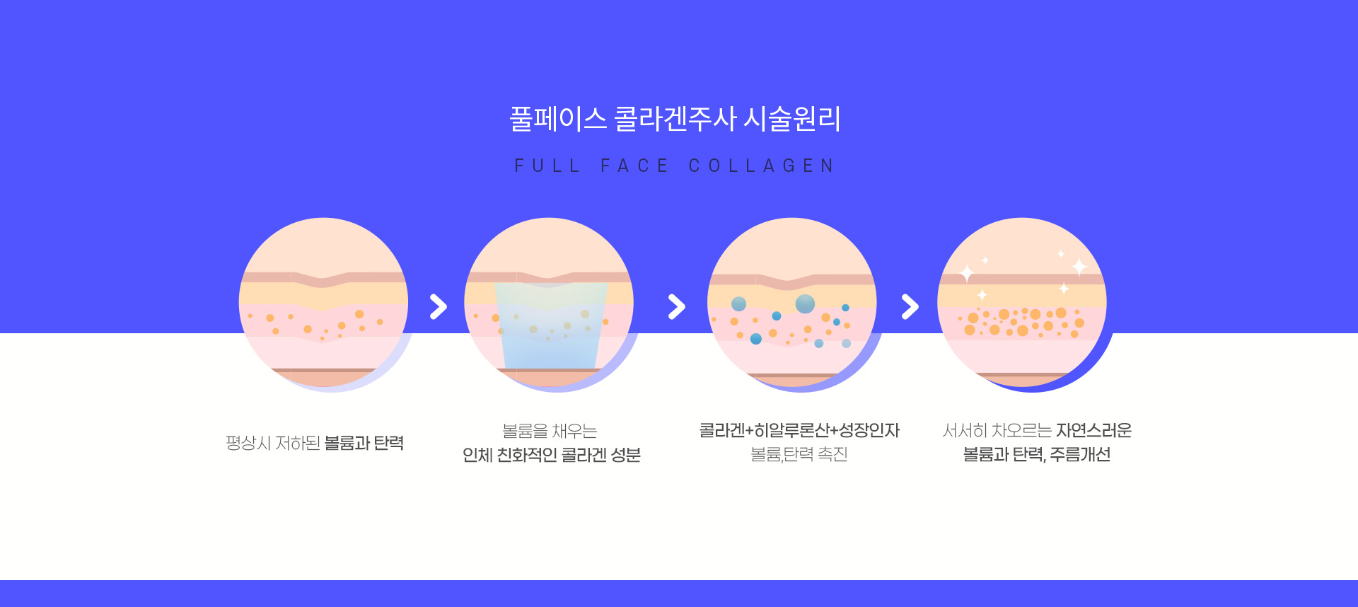 풀페이스 콜라겐주사 시술원리