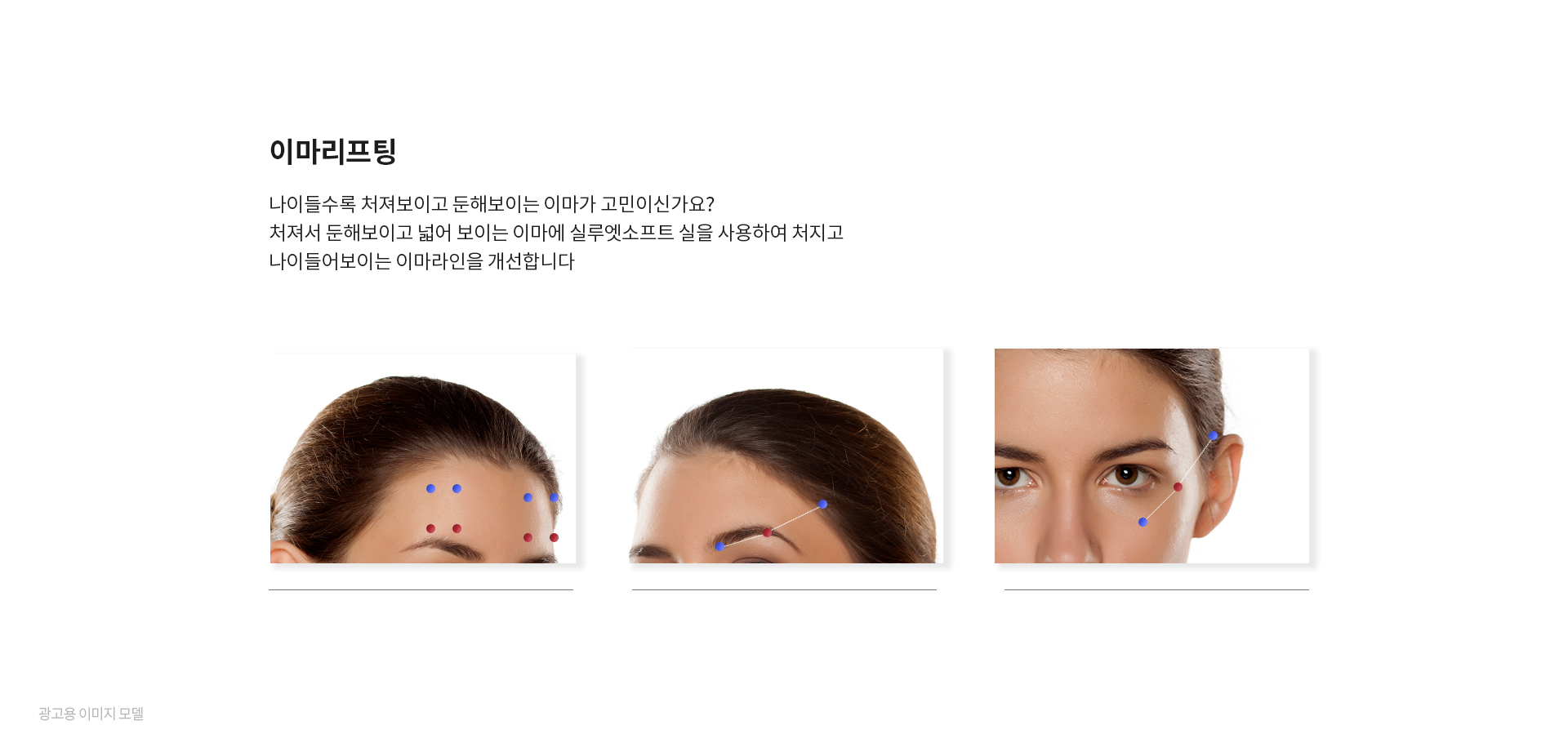 미앤미 실루엣소프트 이마리프팅