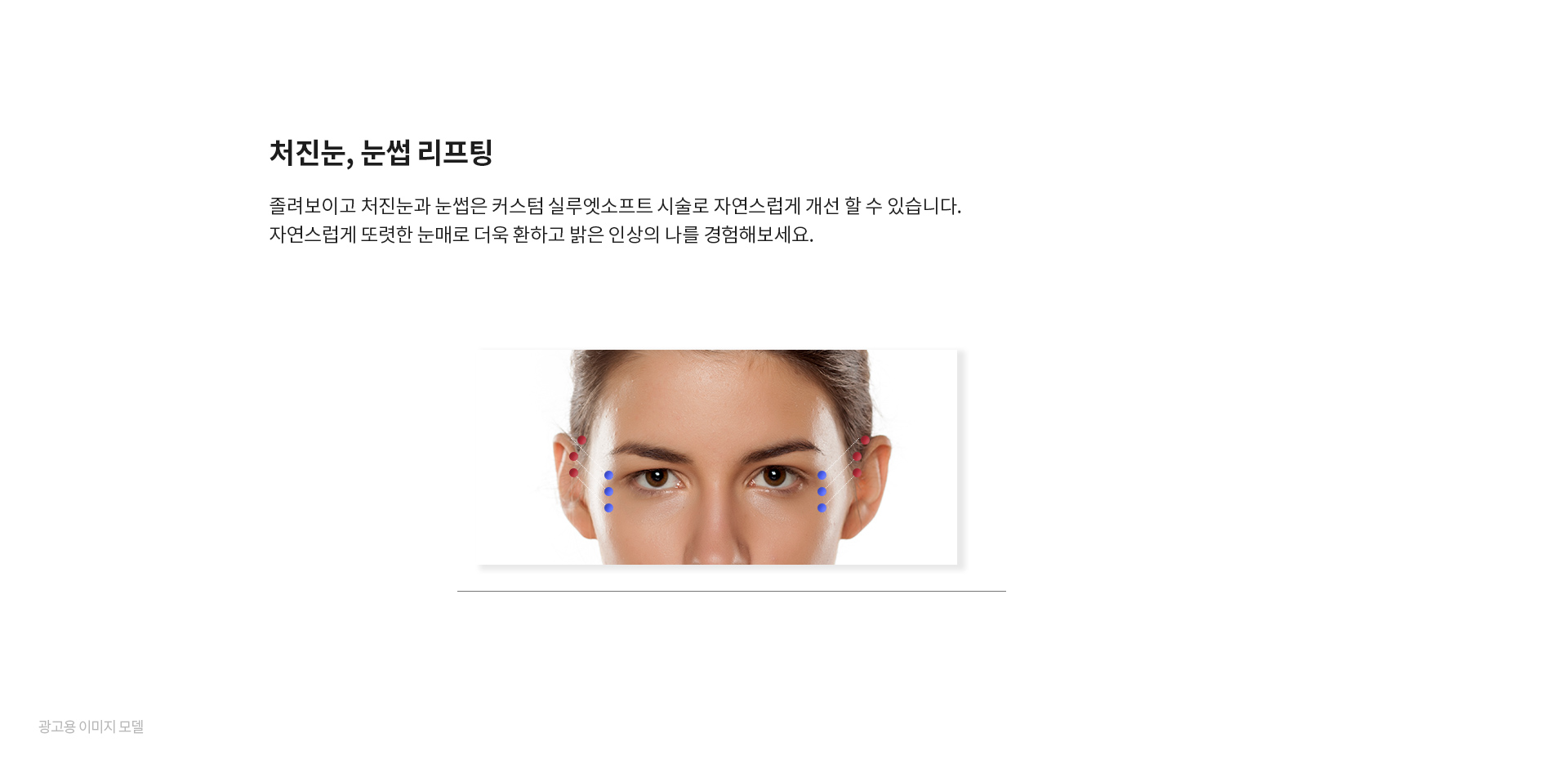 미앤미 실루엣소프트 처진눈, 눈썹 리프팅