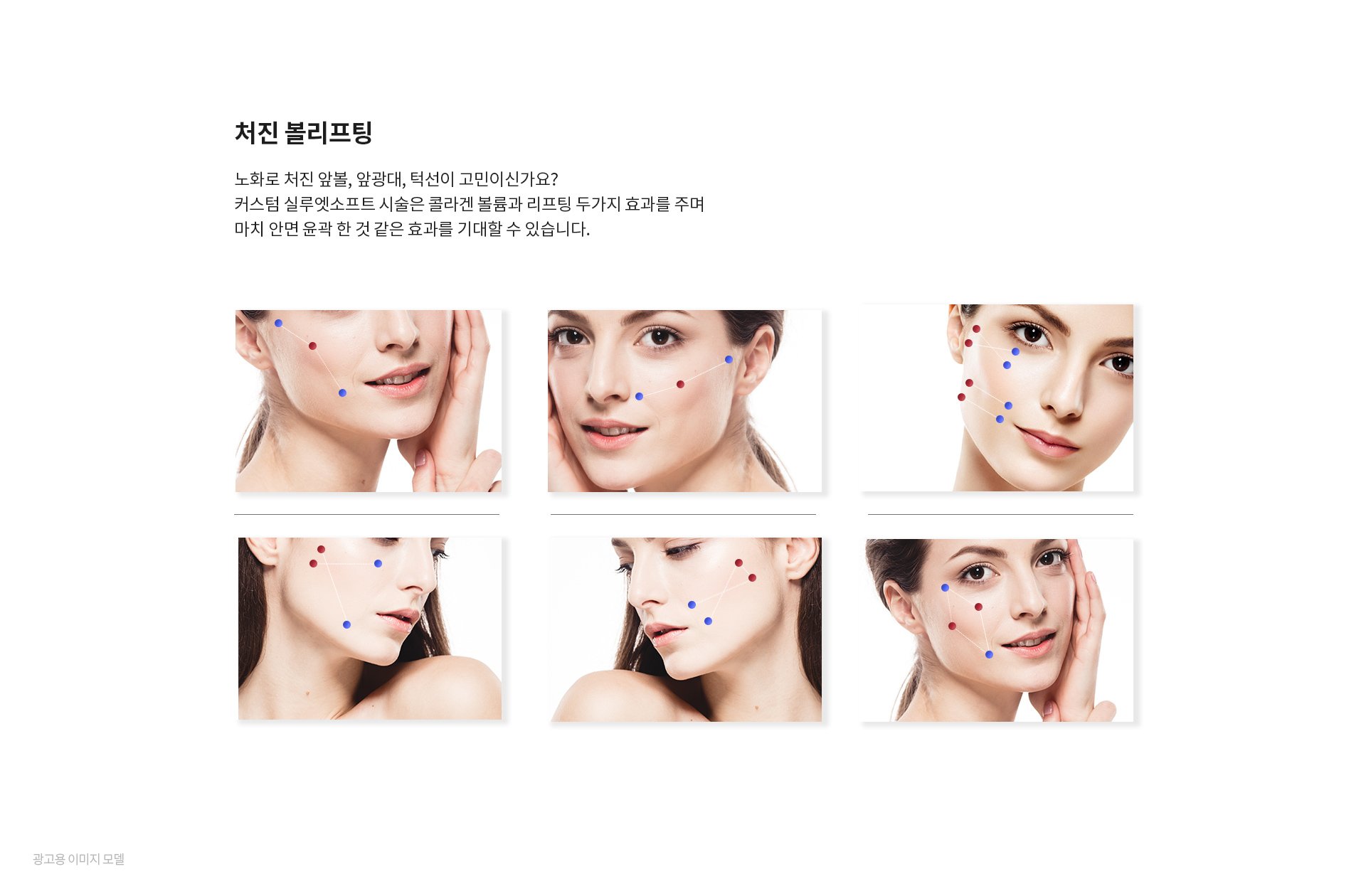 미앤미 실루엣소프트 처진 볼리프팅