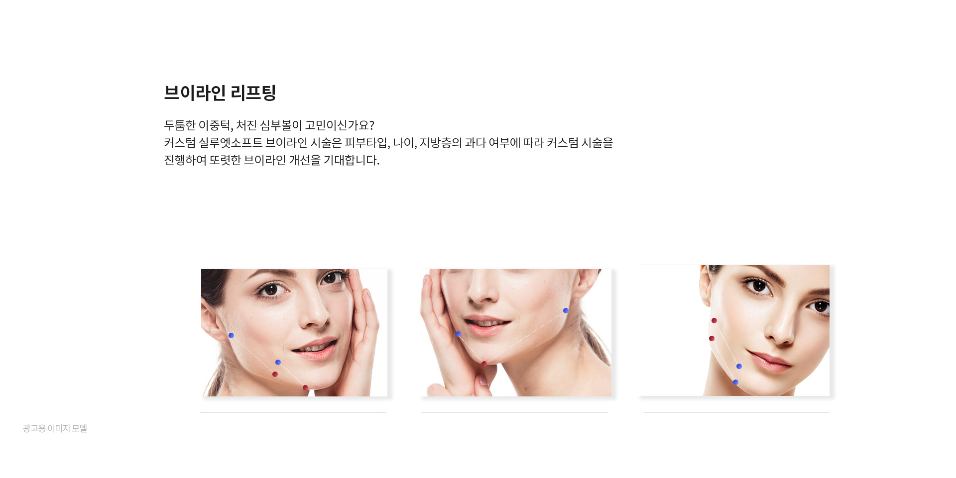 미앤미 실루엣소프트 브이라인 리프팅