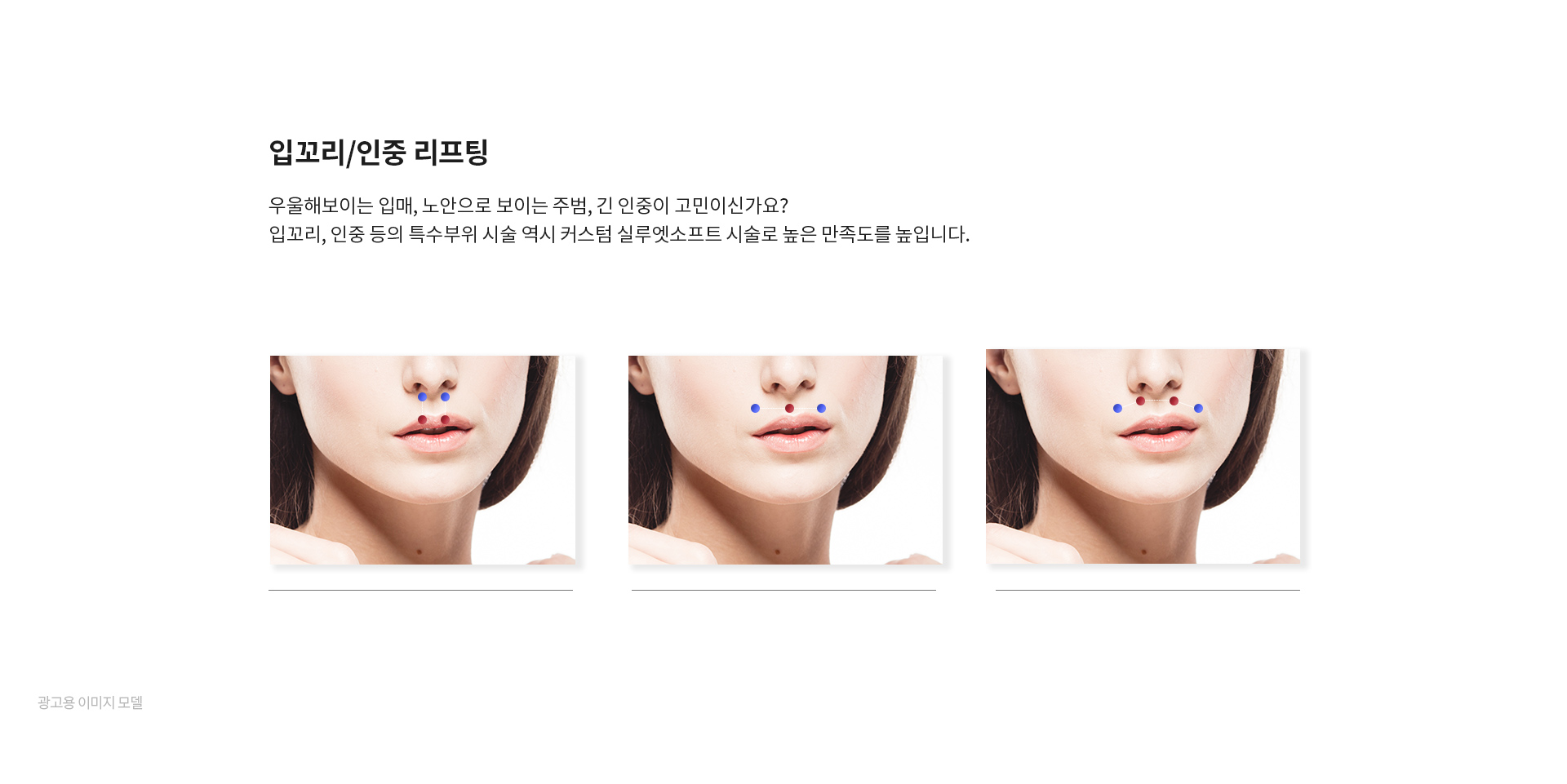 미앤미 실루엣소프트 입꼬리 인중 리프팅