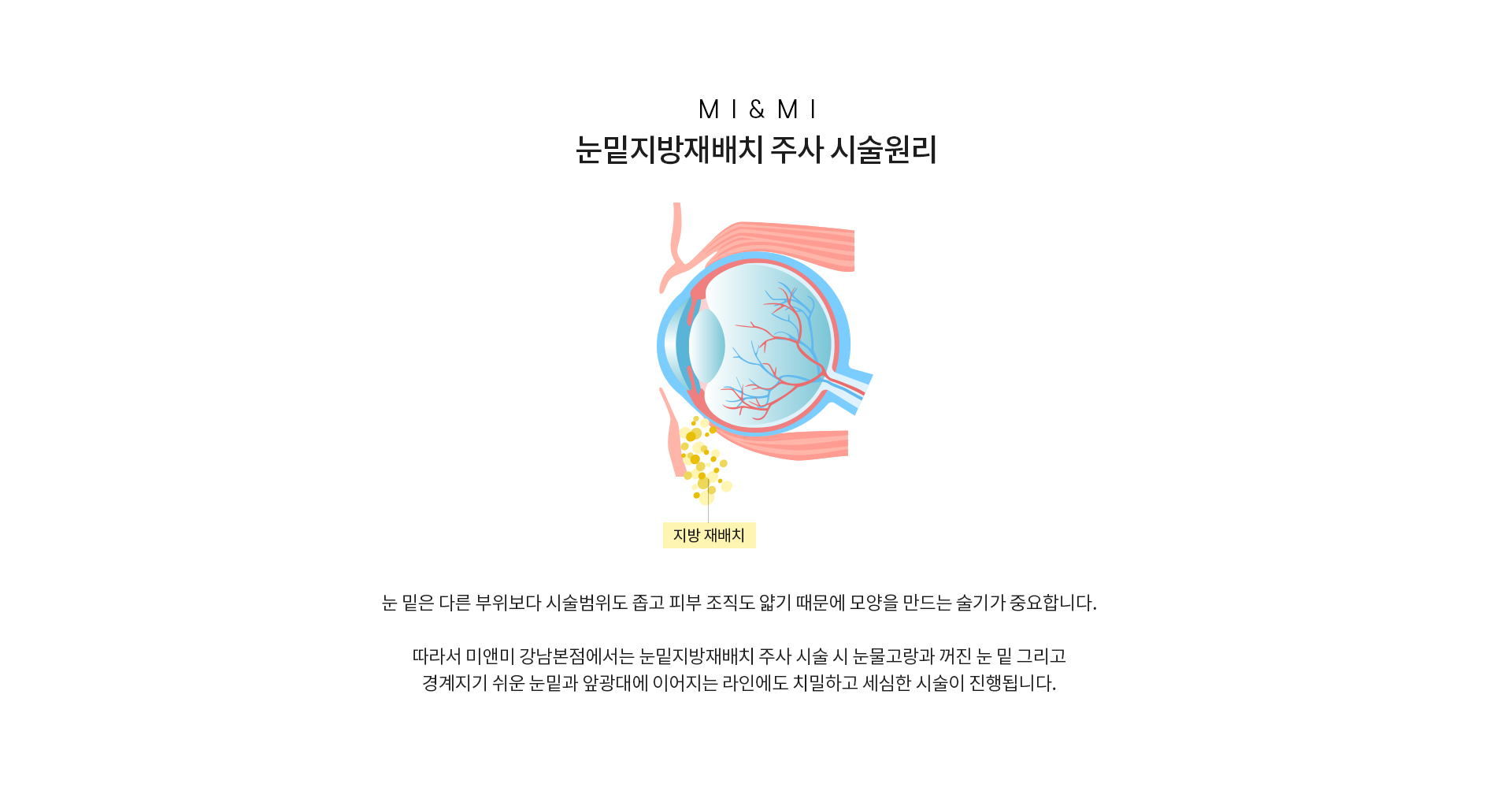 눈밑지방재배치주사 시술원리