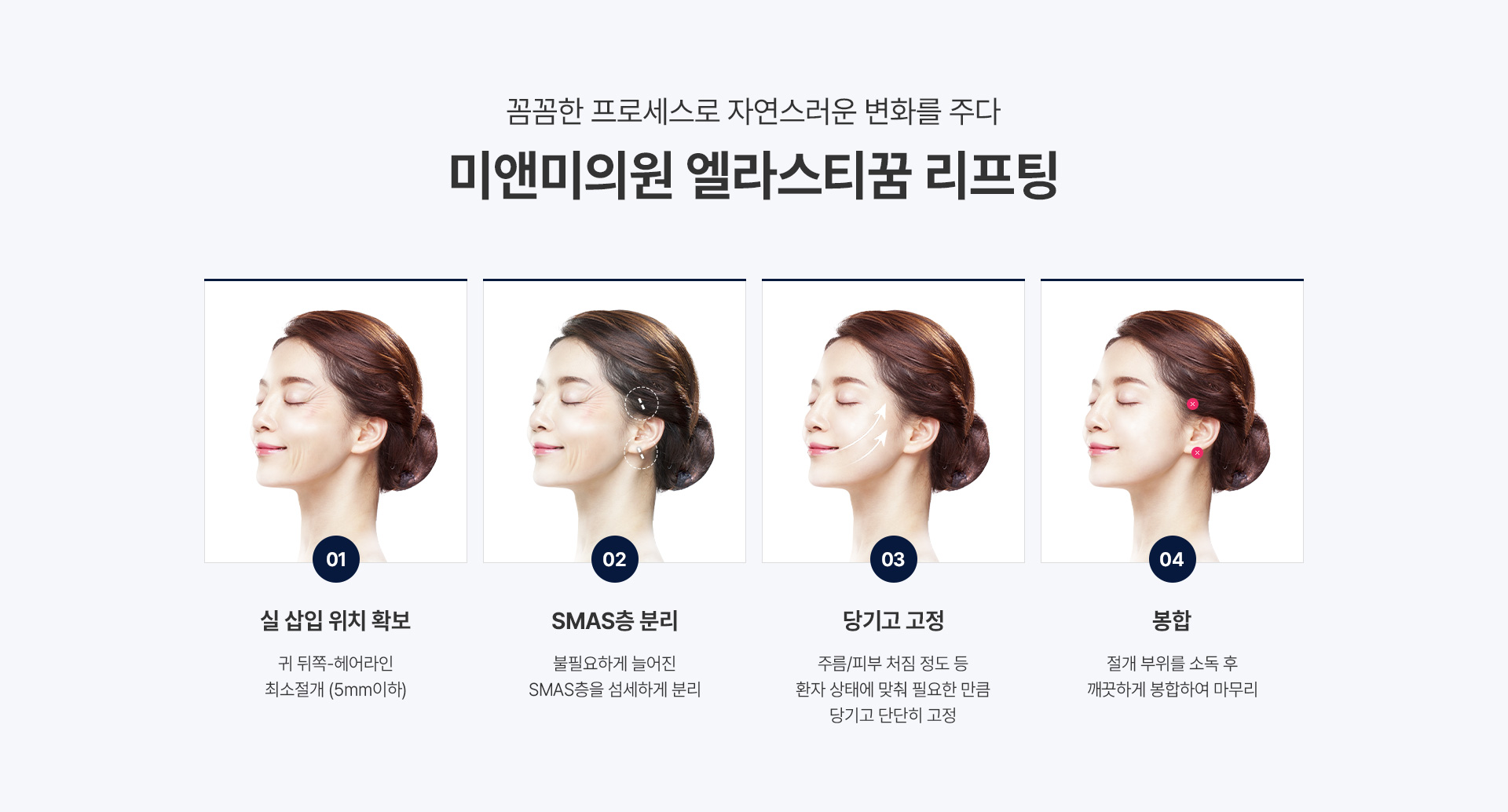 미앤미의원 엘라스티꿈 리프팅