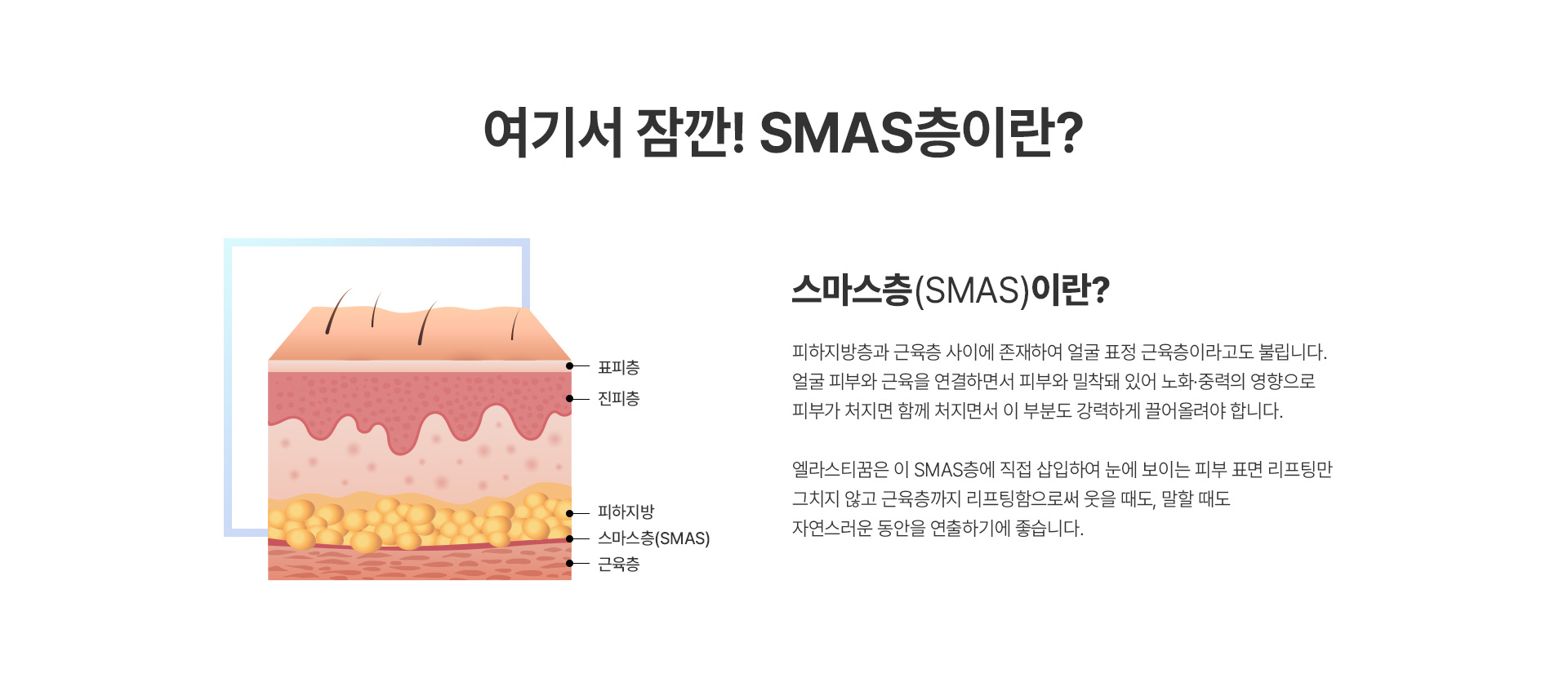 여기서 잠깐! SMAS층이란?