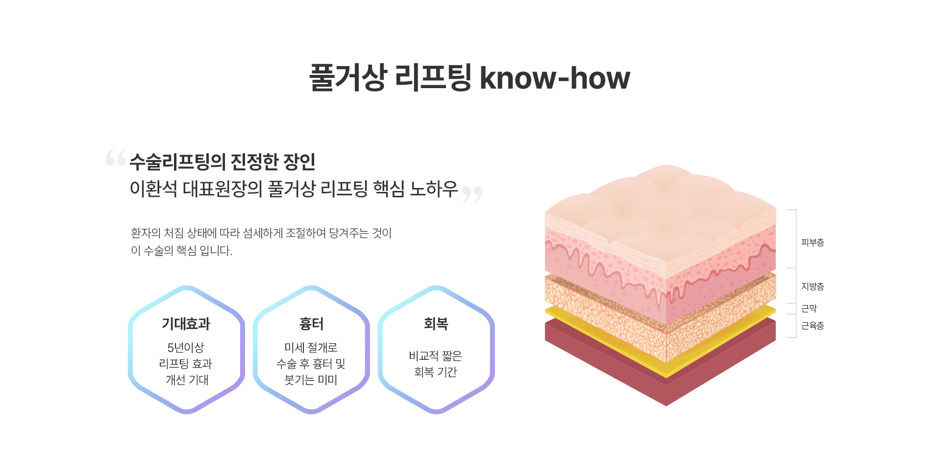 수술리프팅의 진정한 장인, 미앤미 풀거상 know-how