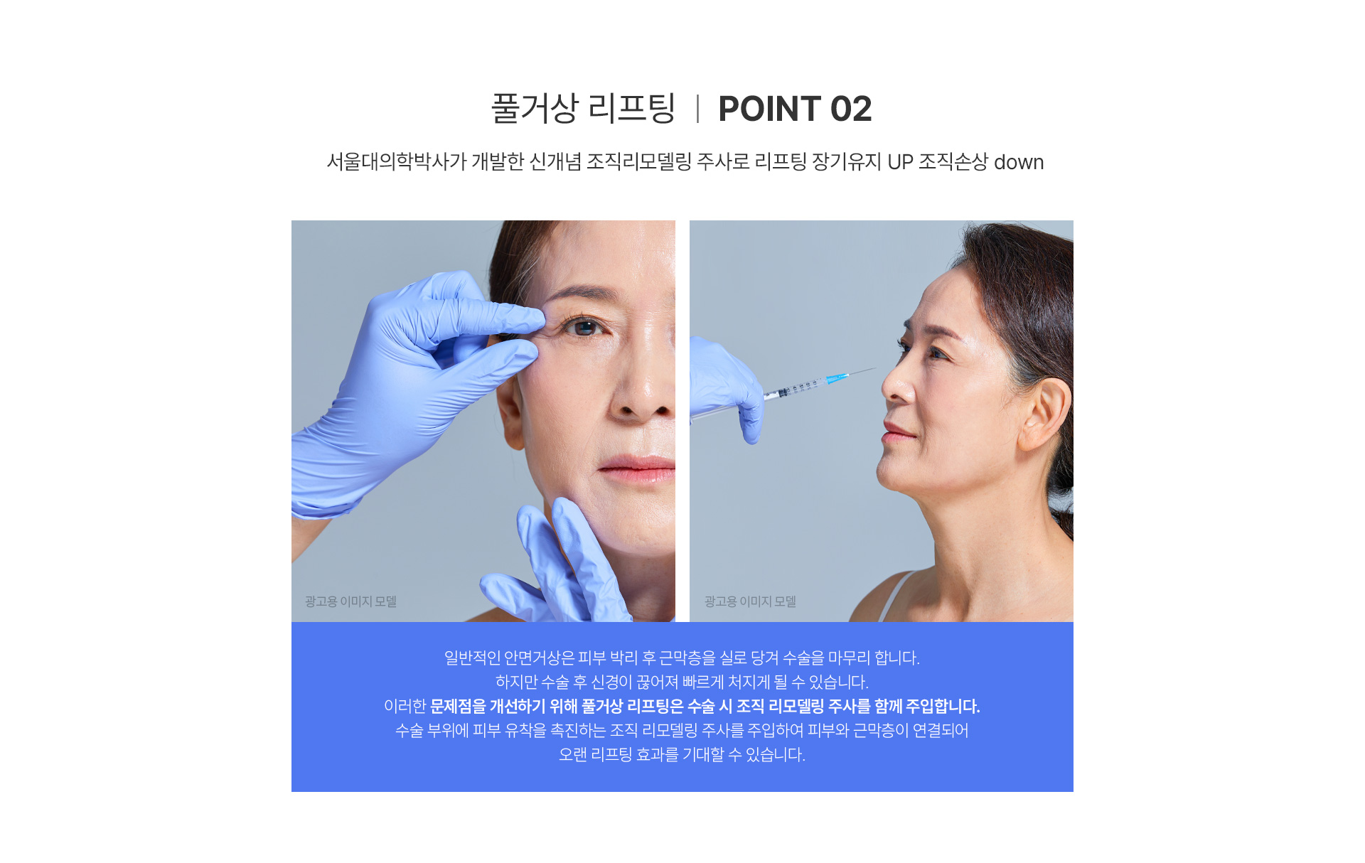 리프팅 장기유지 UP 조직손상 DOWN 미앤미 풀거상