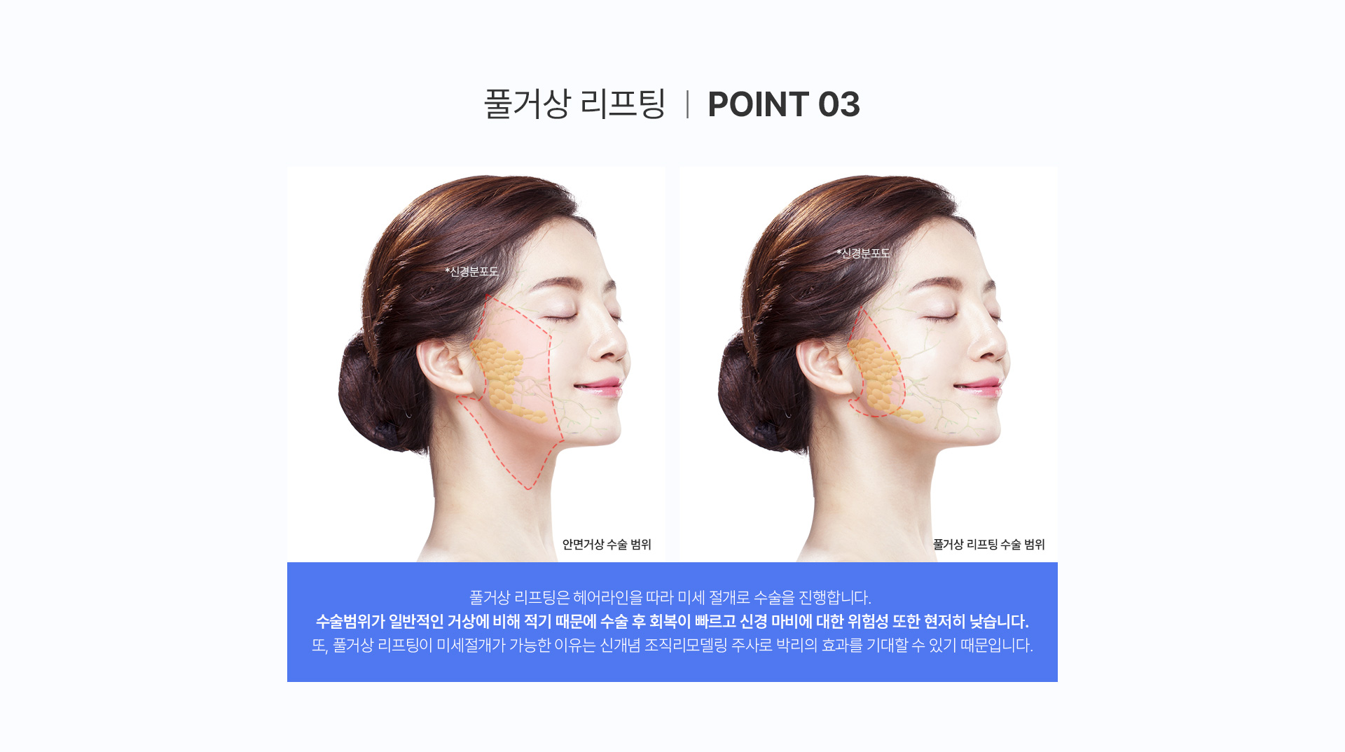 미앤미 풀거상 특징