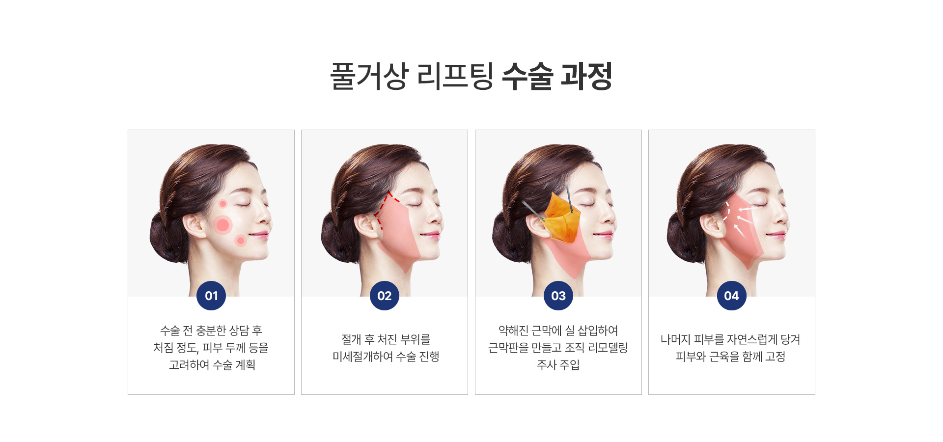 미앤미 풀거상 수술 과정