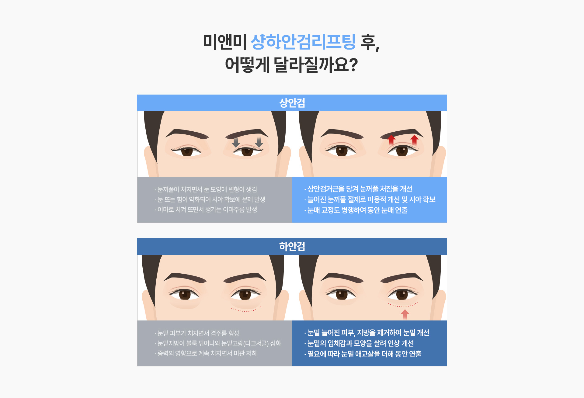 이 중에 2개 이상 해당된다면, 지금 바로 미앤미의 상하안검리프팅이 필요합니다!