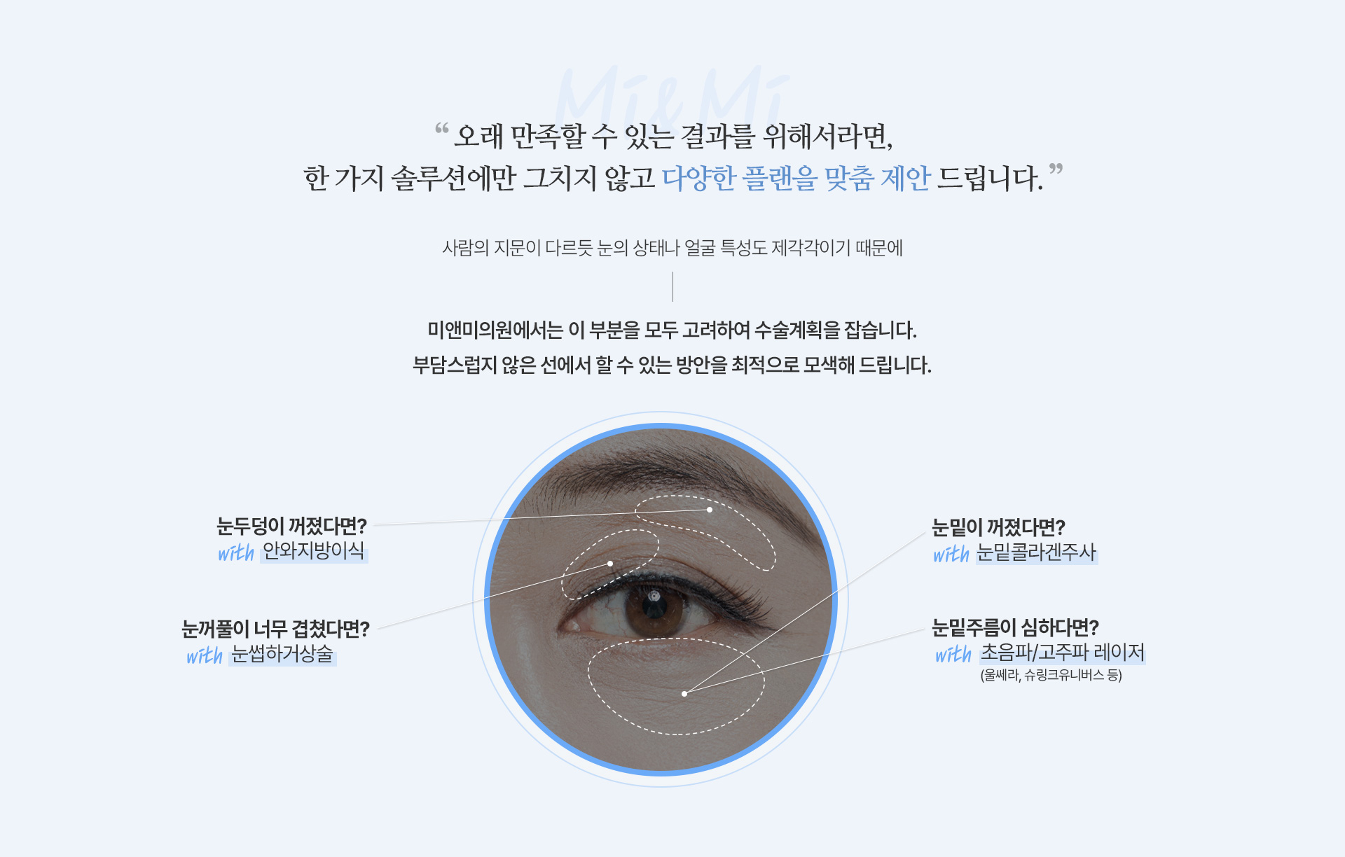 처짐 개선도 회복도 더욱 빠르게! 디테일한 상하안검리프팅 PROCESS