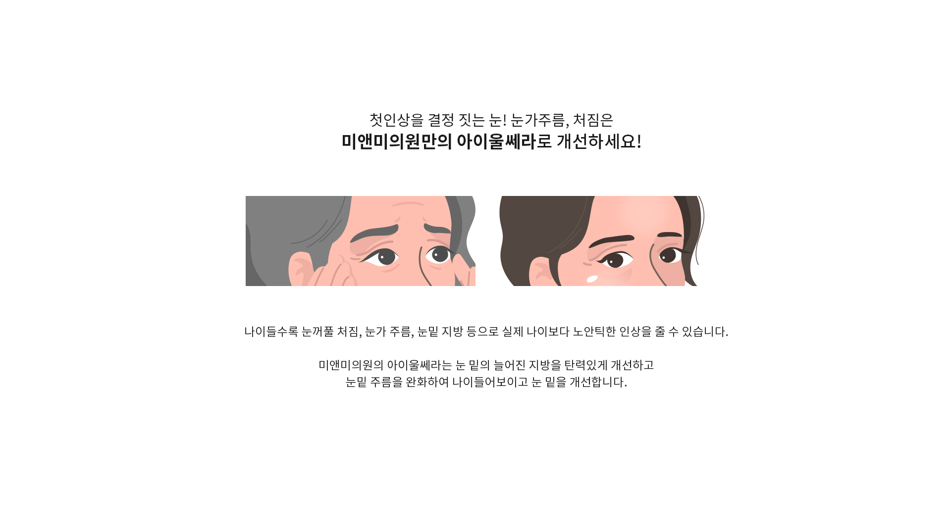 비수술로 간편하게 안면아이을 개선하고 싶다면?