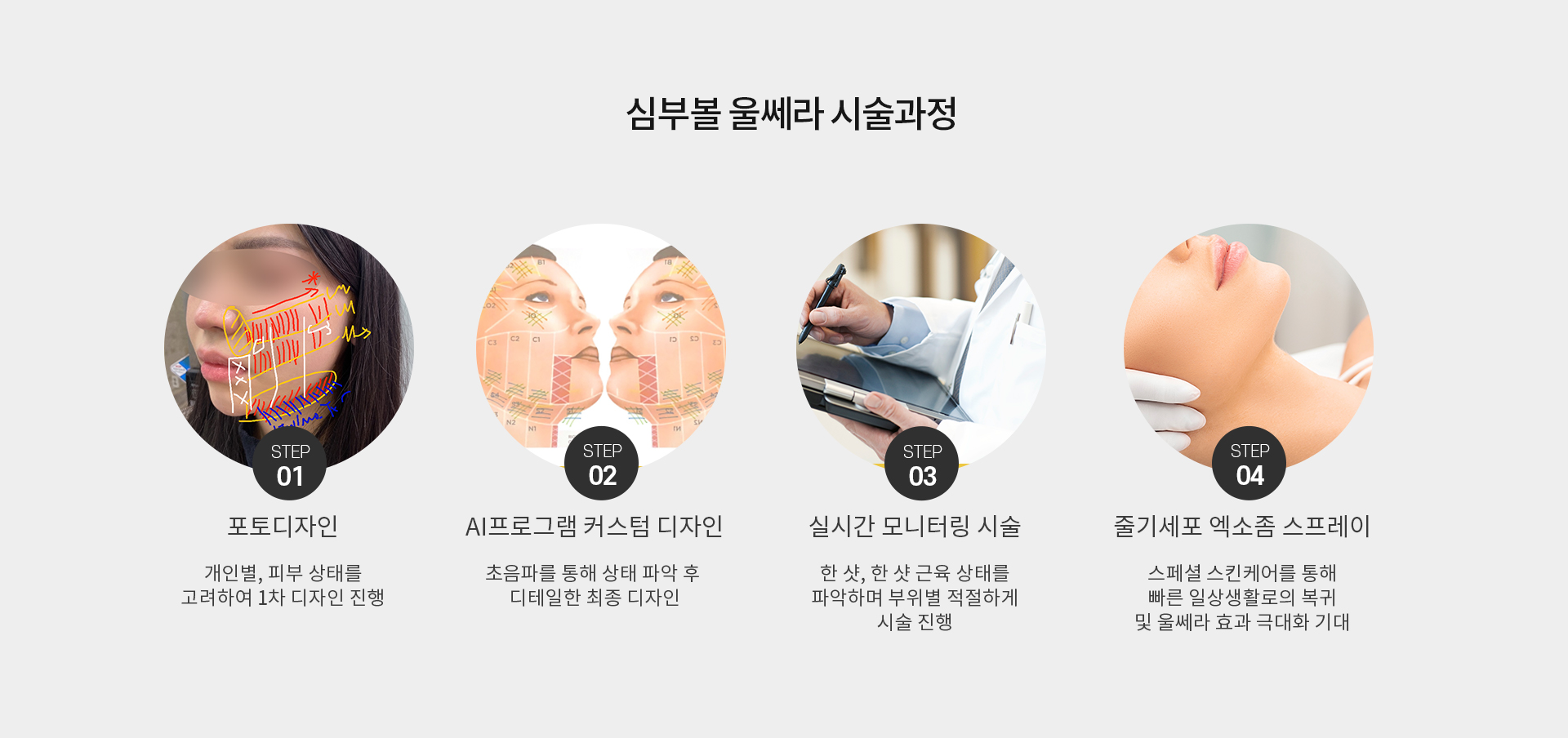 미앤미 심부볼 울쎄라 시술과정