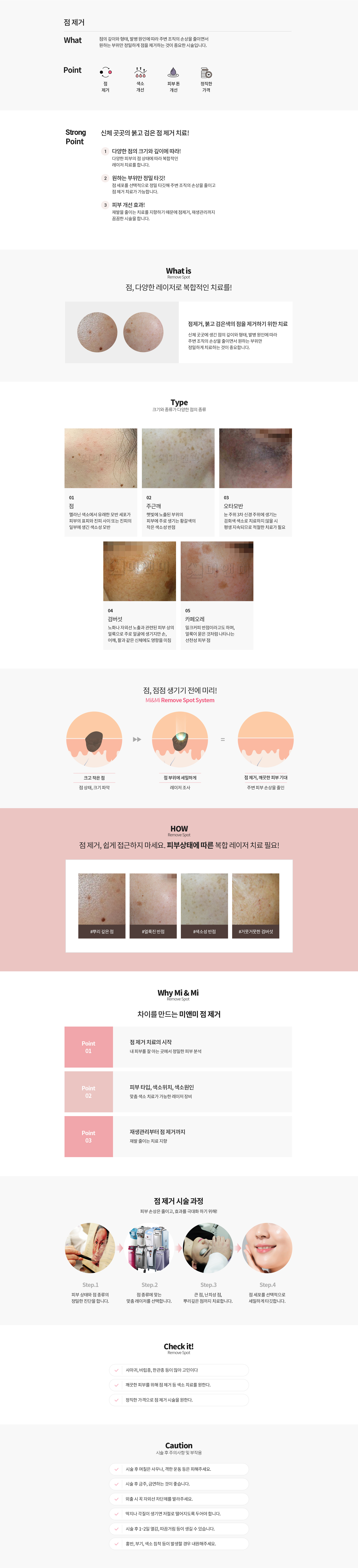 점제거