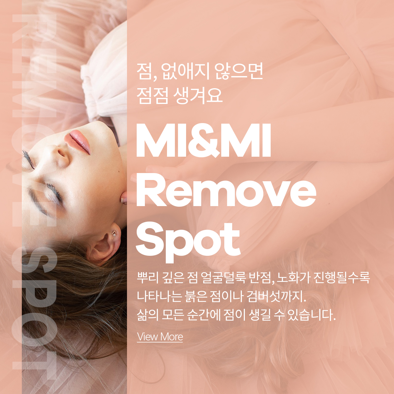점제거