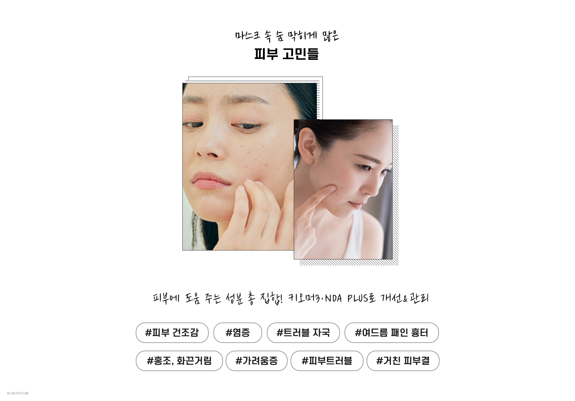 마스크 속 숨 막히게 많은 피부 고민들