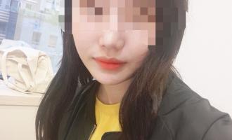 무턱필러 후기