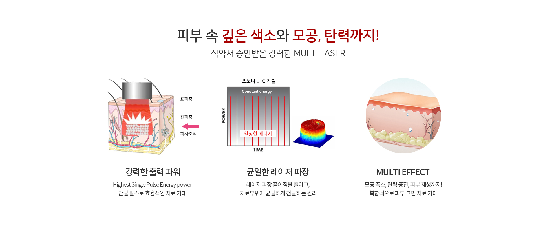 포토나레이저