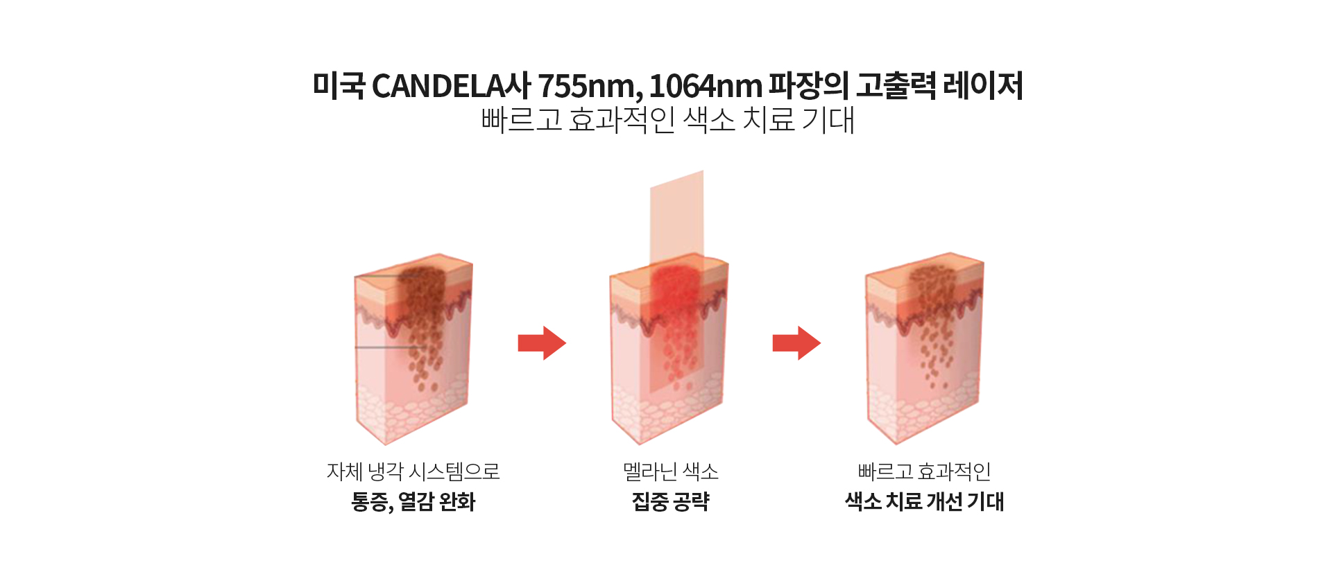 젠틀맥스프로