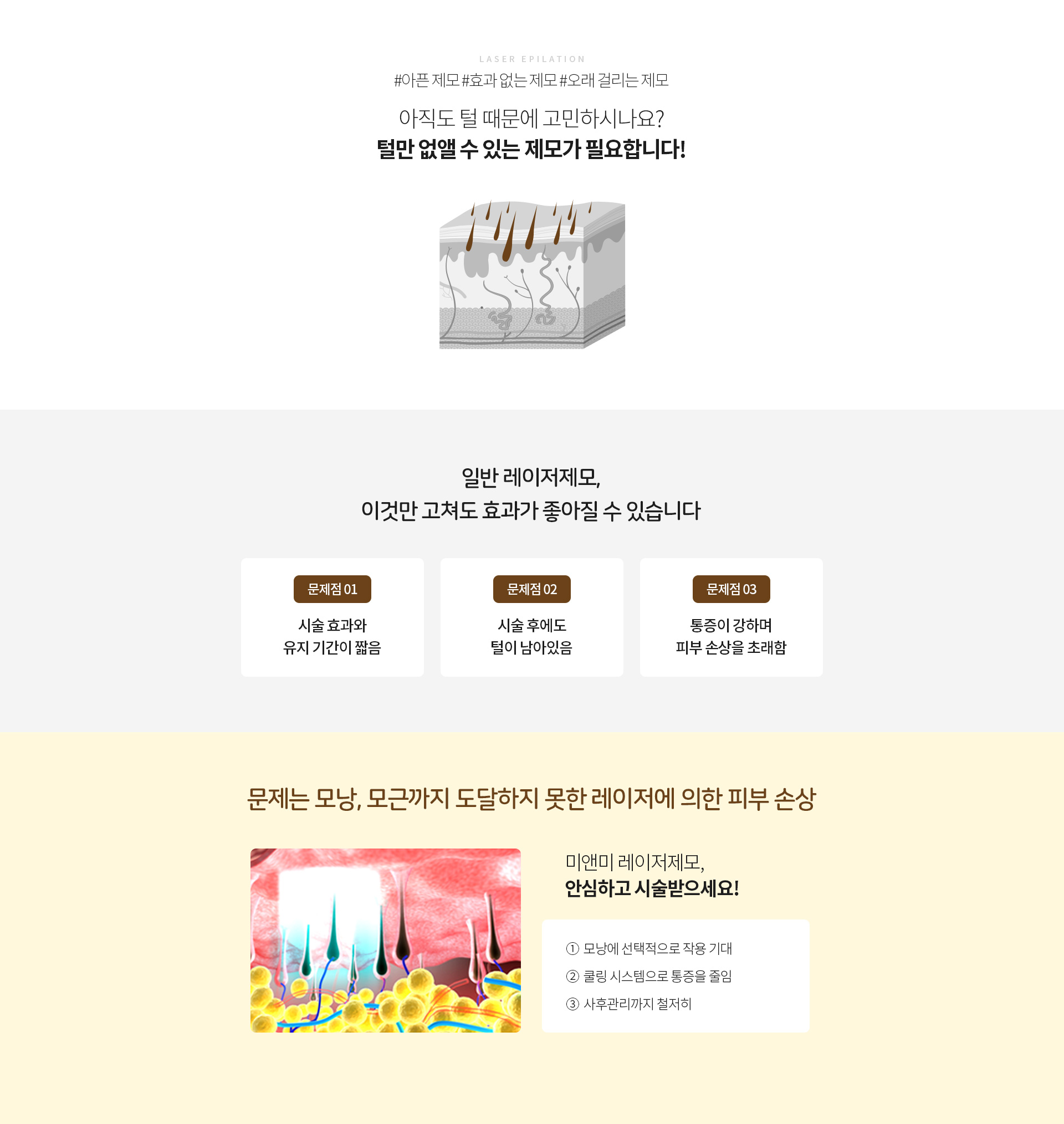 제모효과