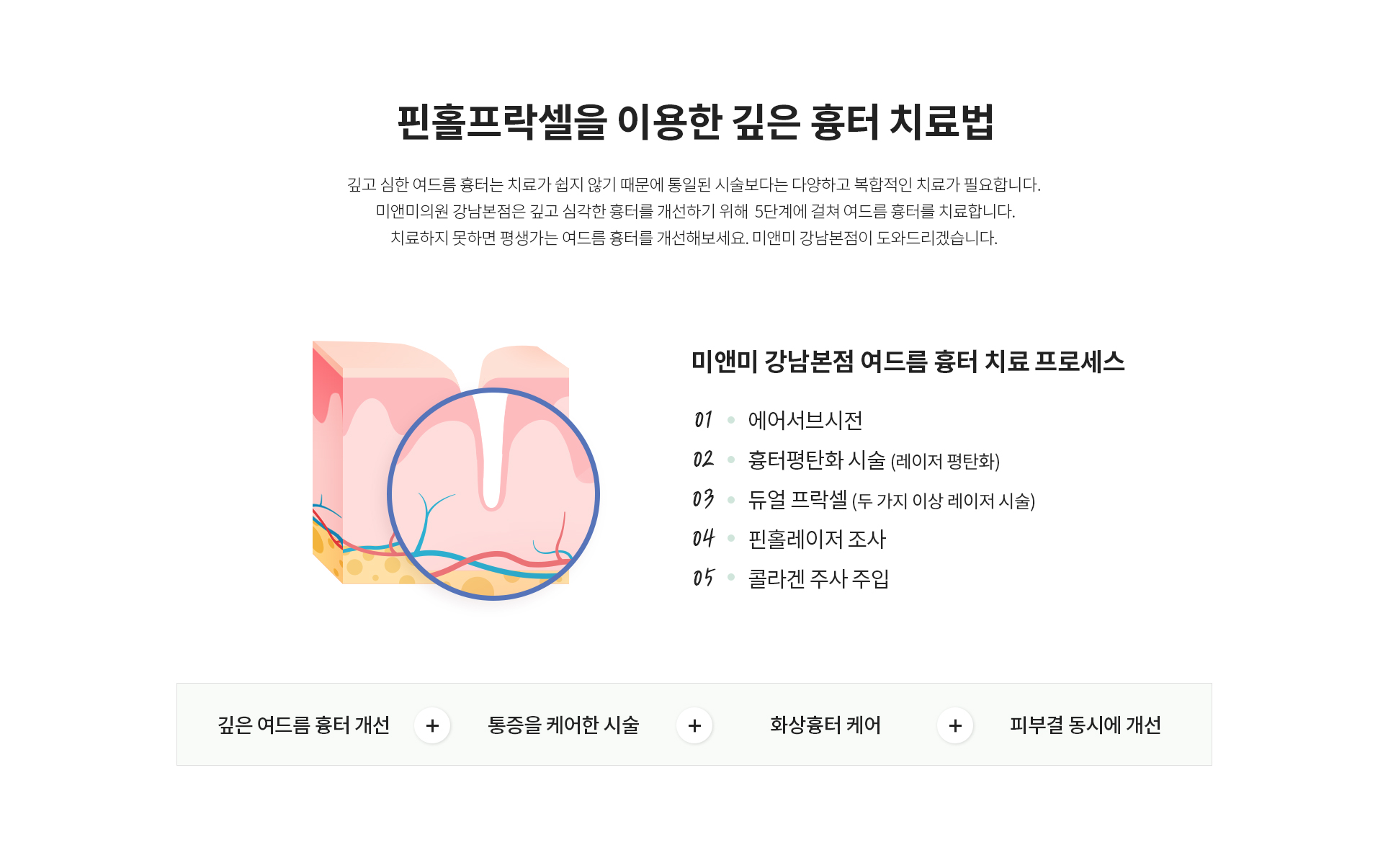 흉터를 개선하기 위한 5단계 여드름 흉터치료 미앤미 핀홀프락셀