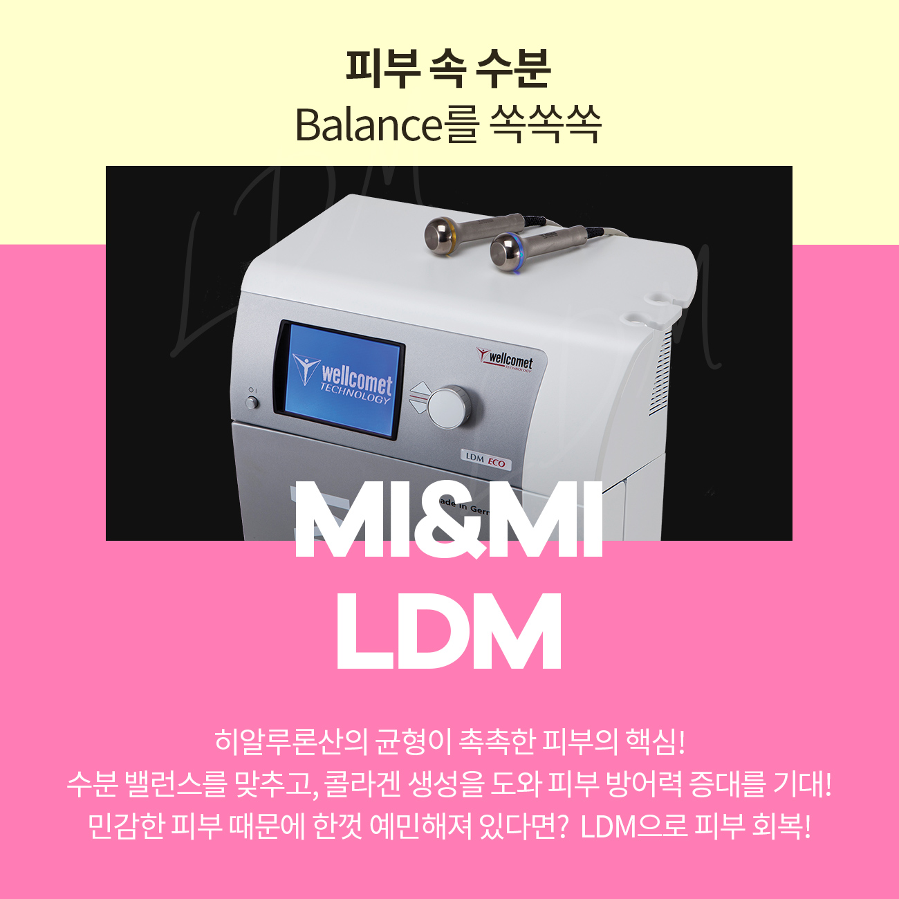 LDM