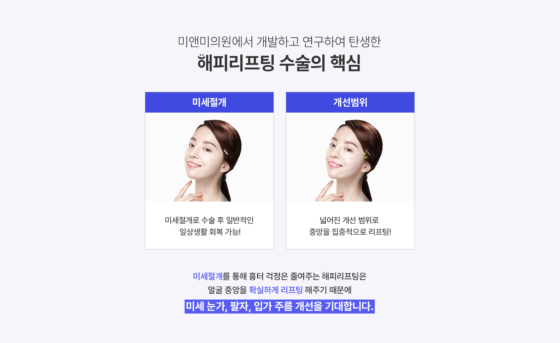 미앤미 해피 리프팅 수술의 핵심