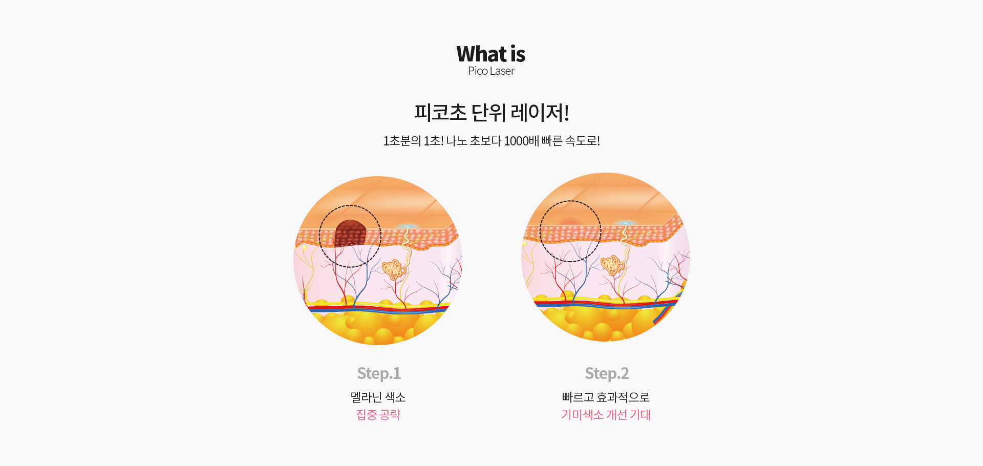 피코레이저 What is