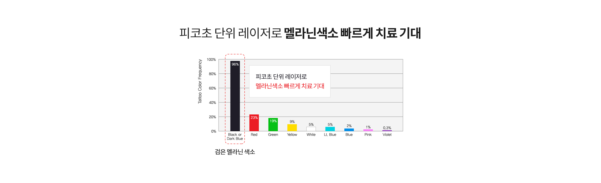 피코레이저 피코초단위레이저