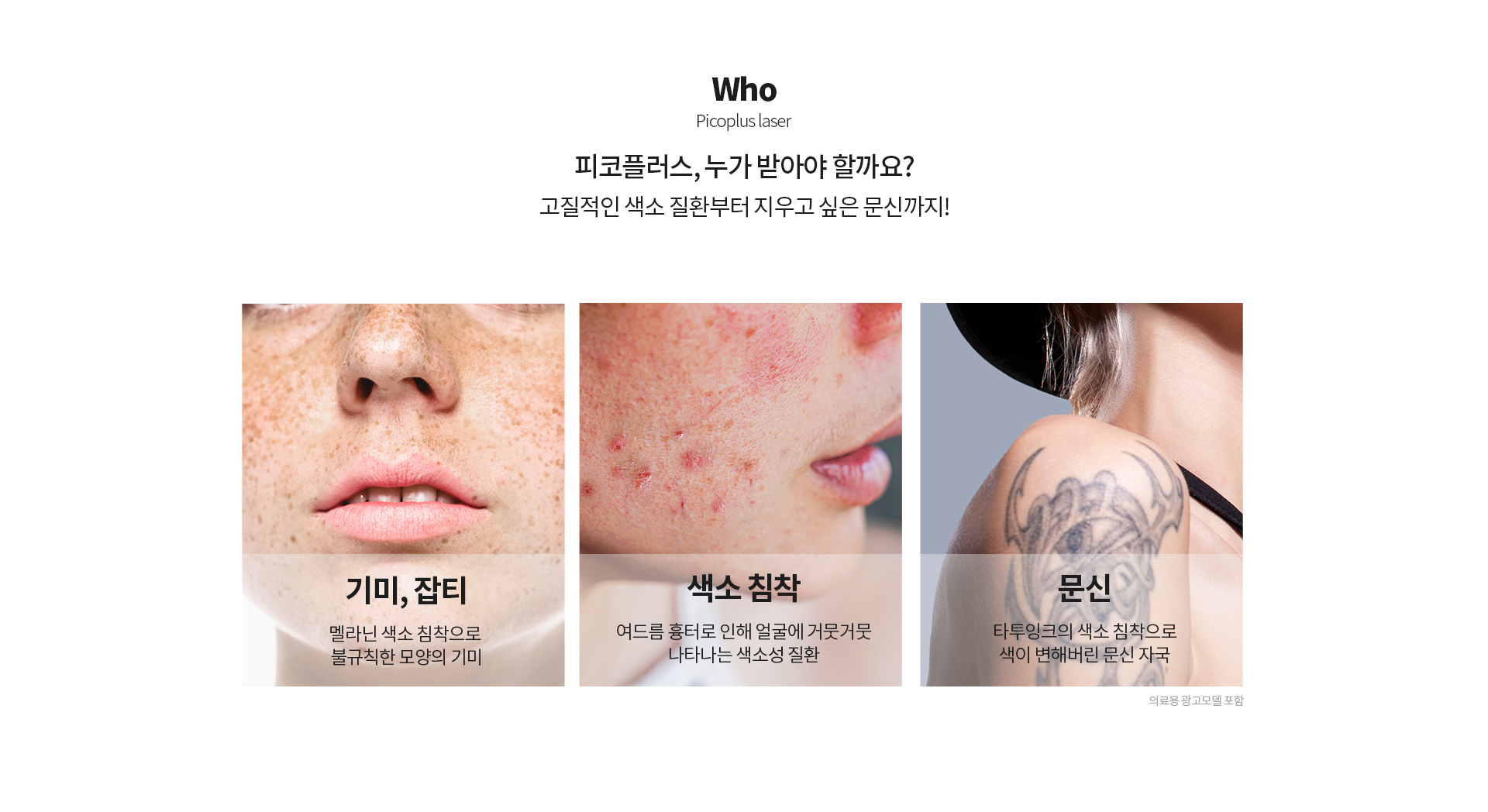 피코플러스 피코 플러스, 누가 받아야 할까요? 고질적인 색소 질환부터 지우고 싶은 문신까지!