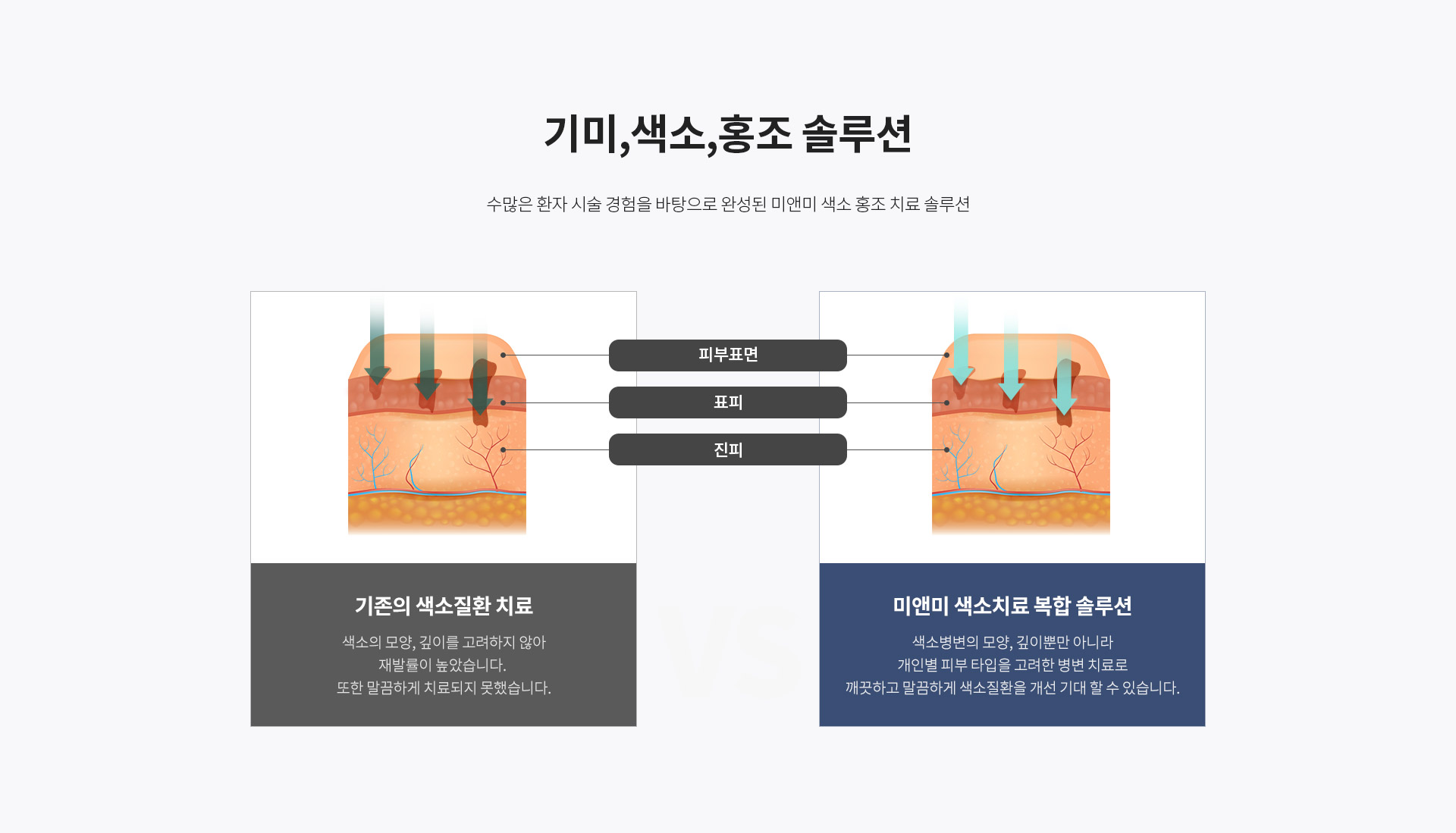 듀얼트리플토닝 기미,색소,홍조 솔루션