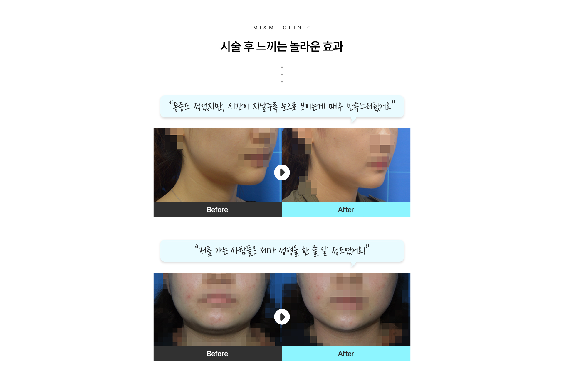 시술 후 느끼는 놀라운 효과