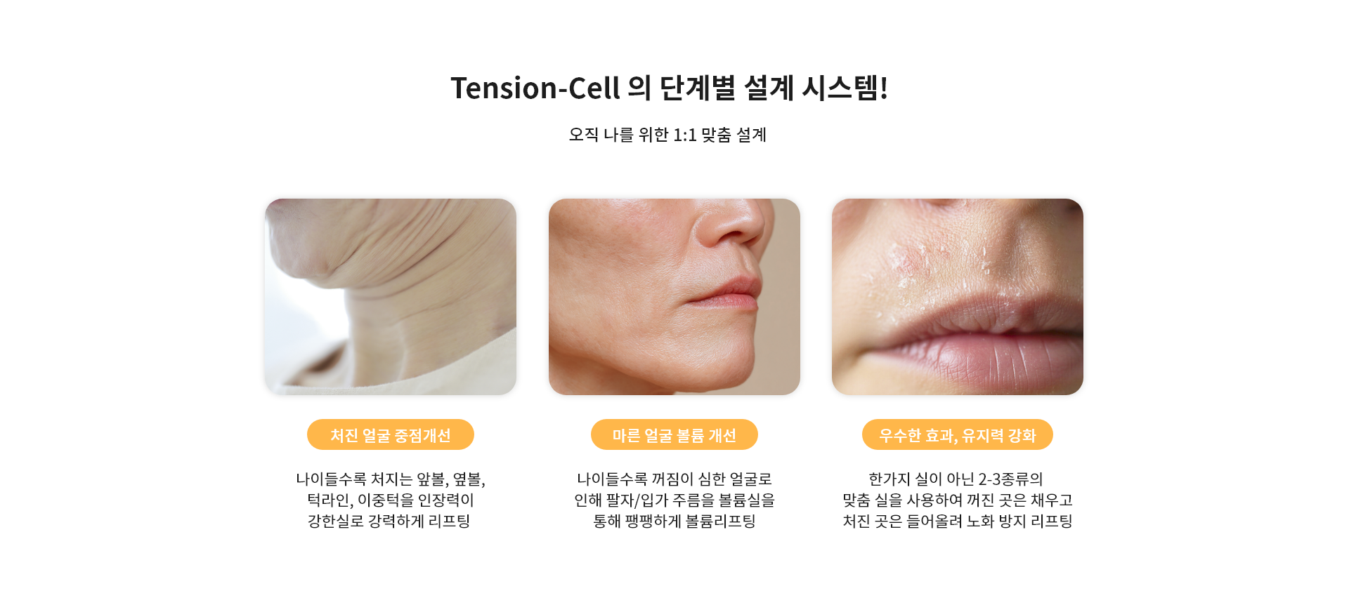 다양한 Tension-Cell, 시술 가능 부위